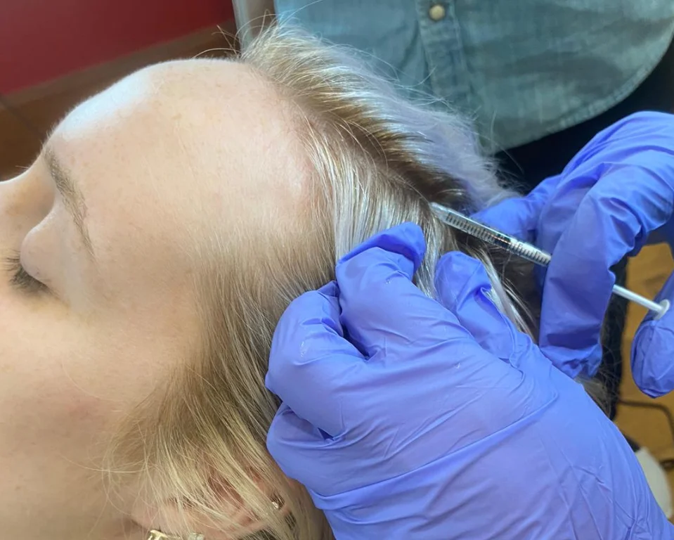 Hair Restoration AW Vancouver