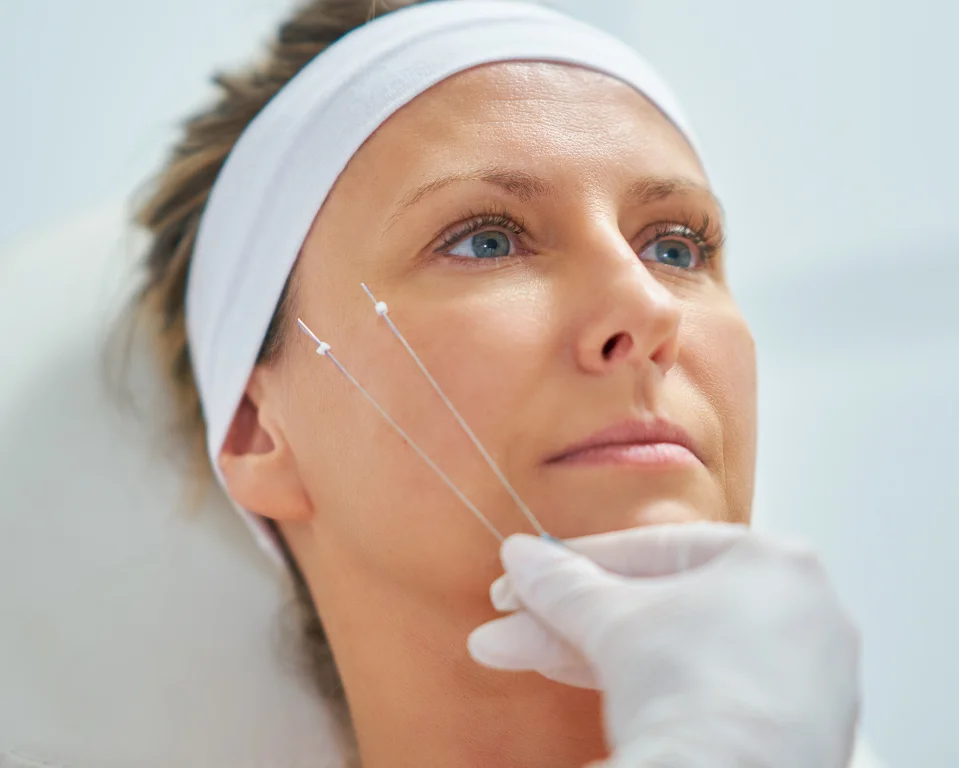 Threadlift AW Vancouver